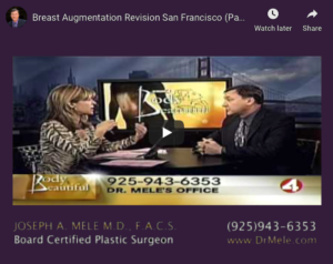 Breast Implant Revision Surgery Video Presentation with before and after pictures
