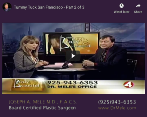 Abdominoplasty Video Presentation with tummy tuck before and after photos