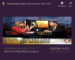 Post Bariatric Plastic Surgery Video Presentation