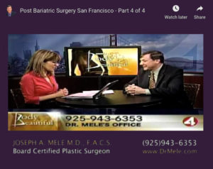 Post Bariatric Plastic Surgery Video Presentation with before and after pictures