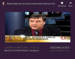 Gynecomastia Reduction Video Presentation (Male Breast Reduction)