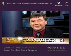 Female Breast Reduction Video Presentation