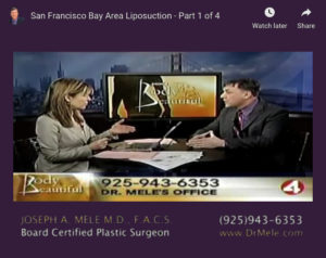 Liposuction Video Presentation