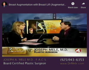 Breast Augmentation and Breast Lift Video Presentation (Mastopexy Augmentation)