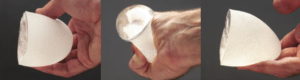 Sientra High-Strength Silicone Gel Breast Implant