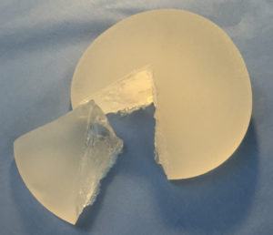 Silicone gel filled breast implants have evolved over the last few decades. The latest options provide soft, string implants filled with a cohesive, gummy-bear gel to reduce the possibility of gel migration.