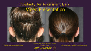 Otoplasty Before and After Pictures Ear Pinning